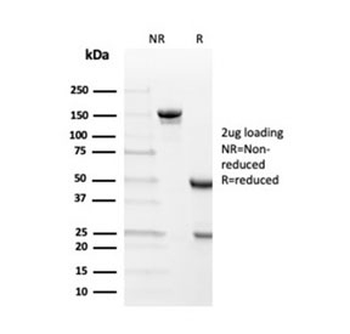 Transthyretin Antibody / TTR / Prealbumin