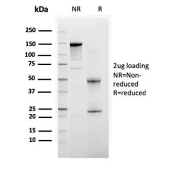 BAP1 Antibody