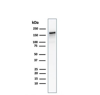 ACE Antibody / Angiotensin I Converting Enzyme