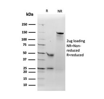 ACE Antibody / Angiotensin I Converting Enzyme