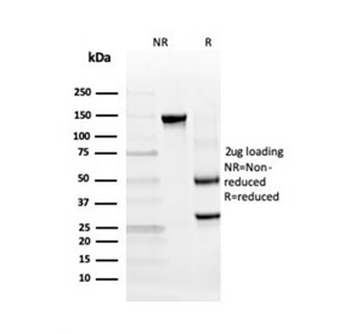 TIM-3 Antibody / HAVCR2