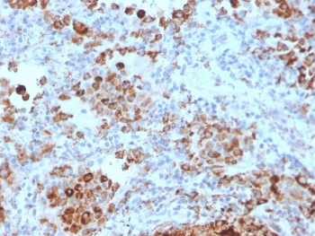 TIM3 Antibody / HAVCR2