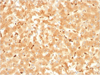 Alpha-2-Macroglobulin Antibody / A2M