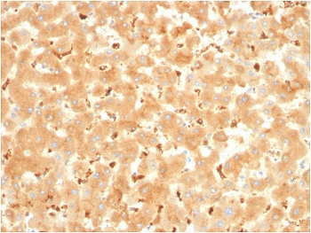 Alpha-2-Macroglobulin Antibody / A2M