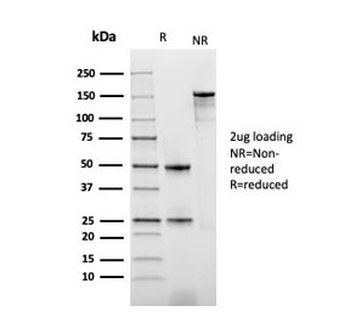 Thymidine Phosphorylase Antibody / PD-ECGF