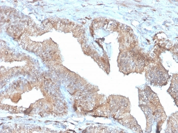 Recombinant PD-ECGF Antibody / Thymidine Phosphorylase