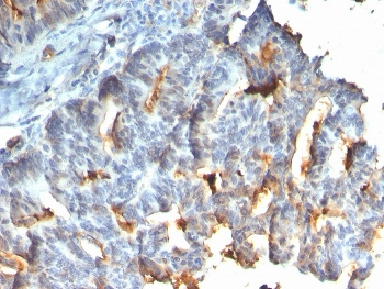 Recombinant Mucin-1 Antibody / MUC1