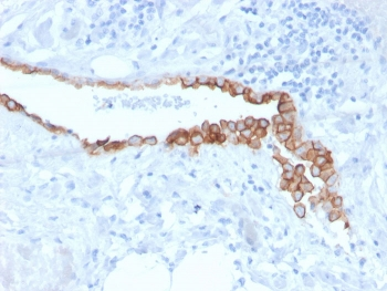 Mesothelin Antibody / MSLN