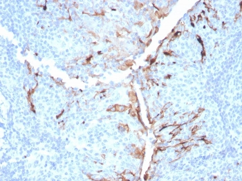 Mesothelin Antibody / MSLN