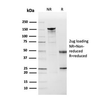 Cystatin A Antibody / CSTA