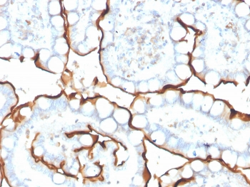 ACE Antibody / Angiotensin I Converting Enzyme