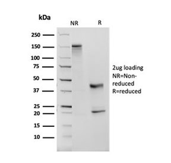 ACE Antibody / Angiotensin I Converting Enzyme