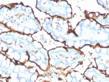 ACE Antibody / Angiotensin I Converting Enzyme
