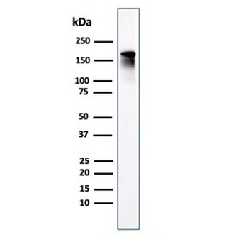 ACE Antibody / Angiotensin I Converting Enzyme