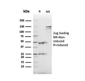 ACE Antibody / Angiotensin I Converting Enzyme