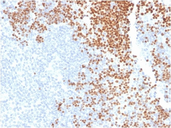 TdT Antibody