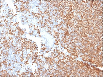 TdT Antibody