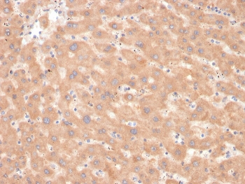 Factor VII Antibody
