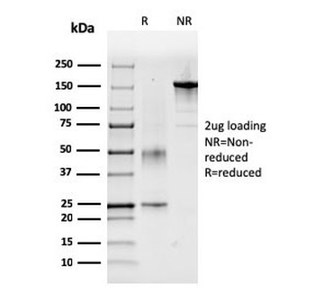 Factor VII Antibody