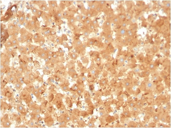 A2M Antibody / Alpha-2-Macroglobulin