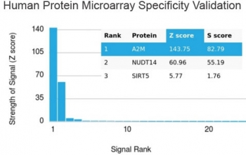 A2M Antibody / Alpha-2-Macroglobulin
