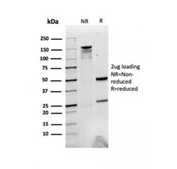 A2M Antibody / Alpha-2-Macroglobulin