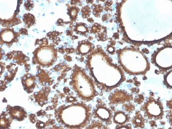 TPO Antibody / Thyroid Peroxidase