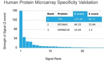 TPO Antibody / Thyroid Peroxidase