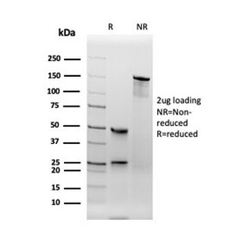 TPO Antibody / Thyroid Peroxidase