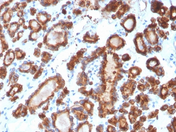 TPO Antibody / Thyroid Peroxidase