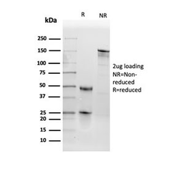TPO Antibody / Thyroid Peroxidase