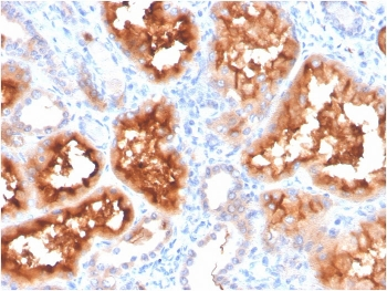 Carbonic Anhydrase IX Antibody / CA9