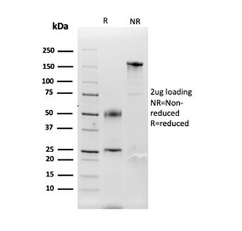 Carbonic Anhydrase IX Antibody / CA9