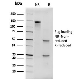His Tag Antibody / Histidine