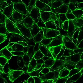 Endoglin Antibody / CD105