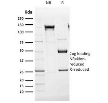 Endoglin Antibody / CD105