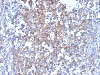 FasL Antibody / Fas Ligand
