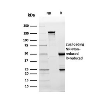 CD10 Antibody