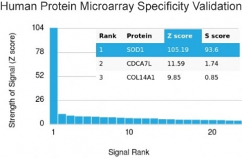 SOD1 Antibody / Superoxide Dismutase 1