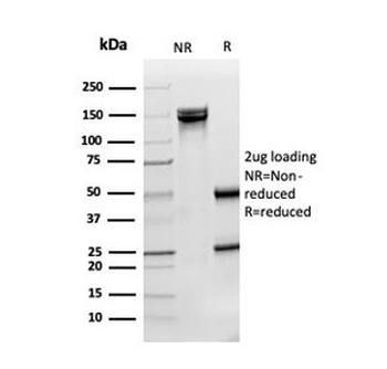 SOD1 Antibody / Superoxide Dismutase 1