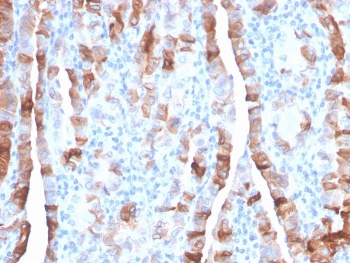 TPO Antibody / Thyroid Peroxidase