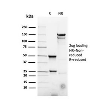 CD22 Antibody / BL-CAM