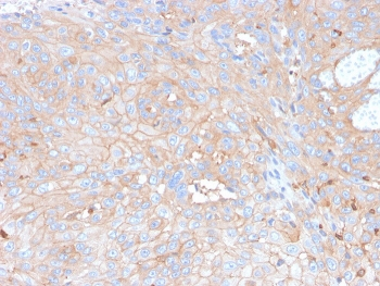 PD-L1 Antibody / B7-H1 / CD274