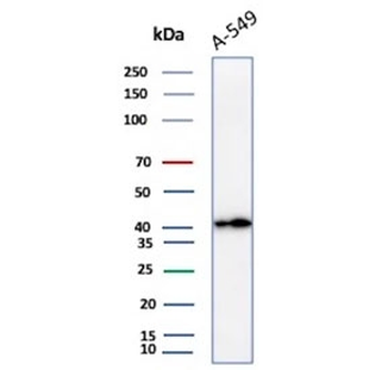 PD-L1 Antibody / B7-H1 / CD274