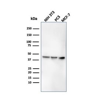 PD-L1 Antibody / B7-H1 / CD274