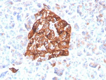Recombinant Synaptophysin Antibody