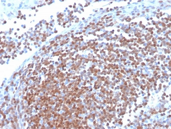 Recombinant Cyclin D1 Antibody