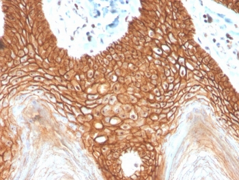 Recombinant E-Cadherin Antibody / CDH1