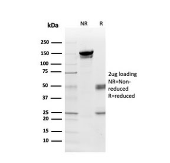 Myelin Basic Protein Antibody