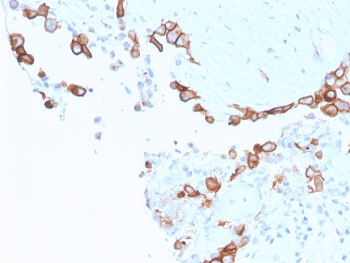 MSLN Antibody / Mesothelin